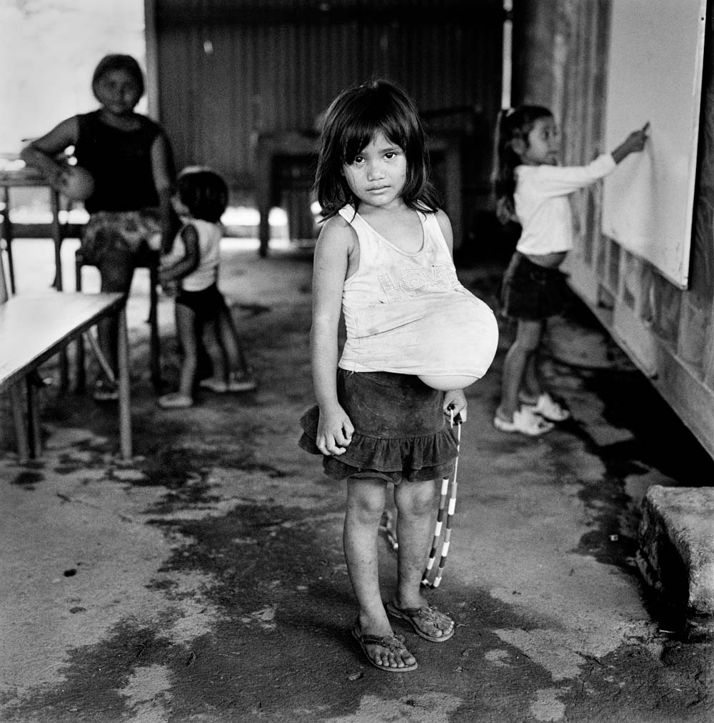 La Chureca  Poor Nicaraguan Kids  Families In Managua Trash Dump-9992